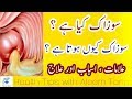 Sozak Kia Hy Sozak Ka Mukammal Ilaj Desi Nuskha