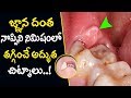 Wisdom Tooth Pain Relief Telugu | Tooth Ache - Natural Ayurvedic Home Remedies