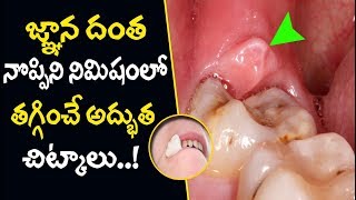 Download lagu Wisdom Tooth Pain Relief Telugu | Tooth Ache - Natural Ayurvedic Home Remedies mp3 Download lagu Wisdom Tooth Pain Relief Telugu | Tooth Ache - Natural Ayurvedic Home Remedies mp3