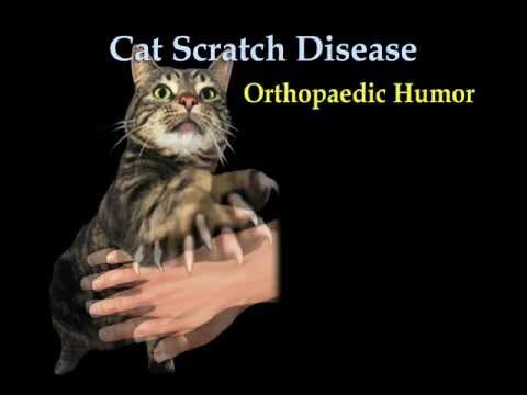 Cat Scratch fever  - Everything You Need To Know - Dr. Nabil Ebraheim