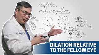 Diagnosing Optic Neuropathy | Houston Methodist