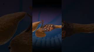 Download lagu 3D Animation of Pancreas Damage [Medical Animation] mp3