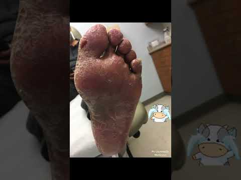 Foot doctor to the rescue