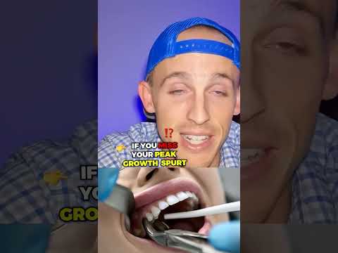 If you have OVERJET, you NEED to see your ORTHO NOW!! 😬🦷