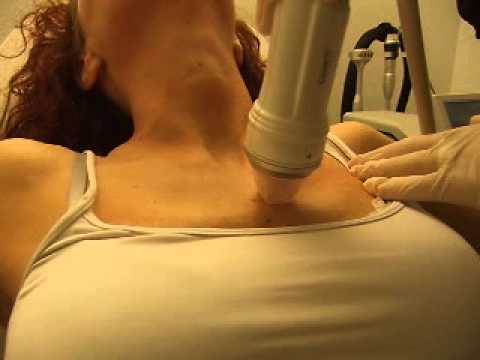 Valgusknie bei Kindern Massage Die Zahlen Thorax