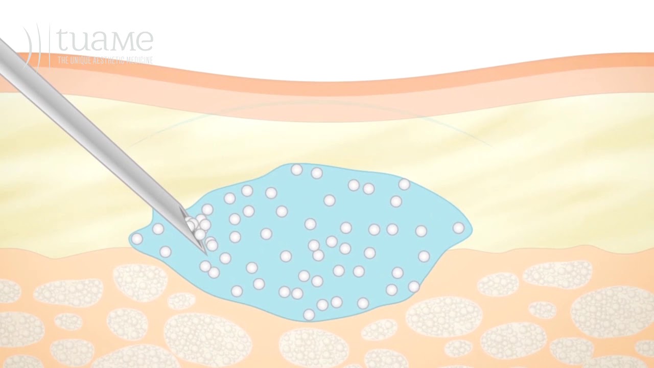 Massimo Ippolito Savì-3