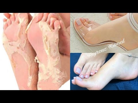 ربع كوب خل وقولي وداعآ لتشققات وخشونه القدمين مجربة مني شخصيآ تقشير . تبييض . ترطيب . بياض كاتلج هنا hana