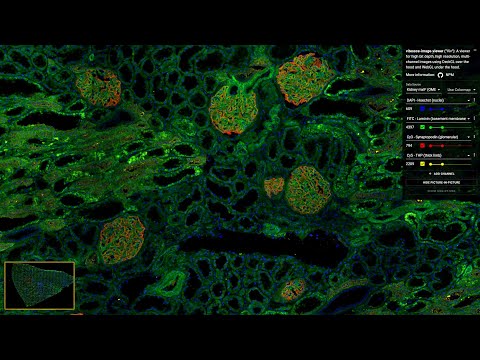 HuBMAP Portal Design and Usage: Data and Code in 1st Portal Release