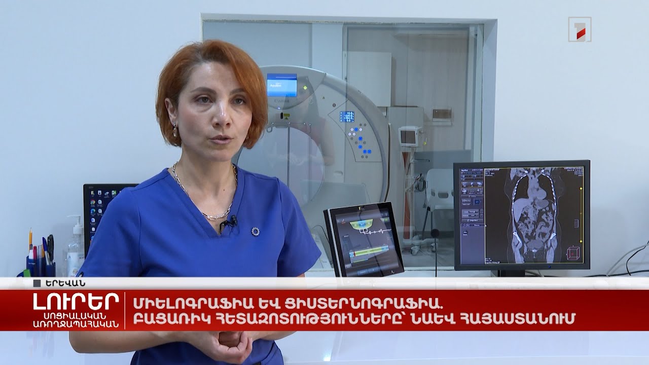 Միելոգրաֆիա և ցիստերնոգրաֆիա. բացառիկ հետազոտությունները՝ նաև Հայաստանում