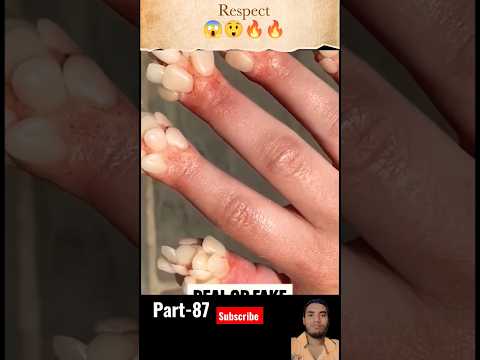 Respect video part-87🔥🔥😱#sort #viral #viralvideo