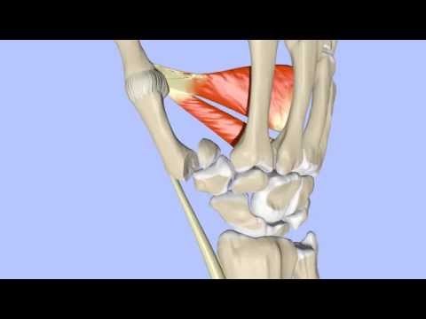 Frakturen der Basis des 1. Mittelhandknochens: Bennett- und Rolando-Frakturen