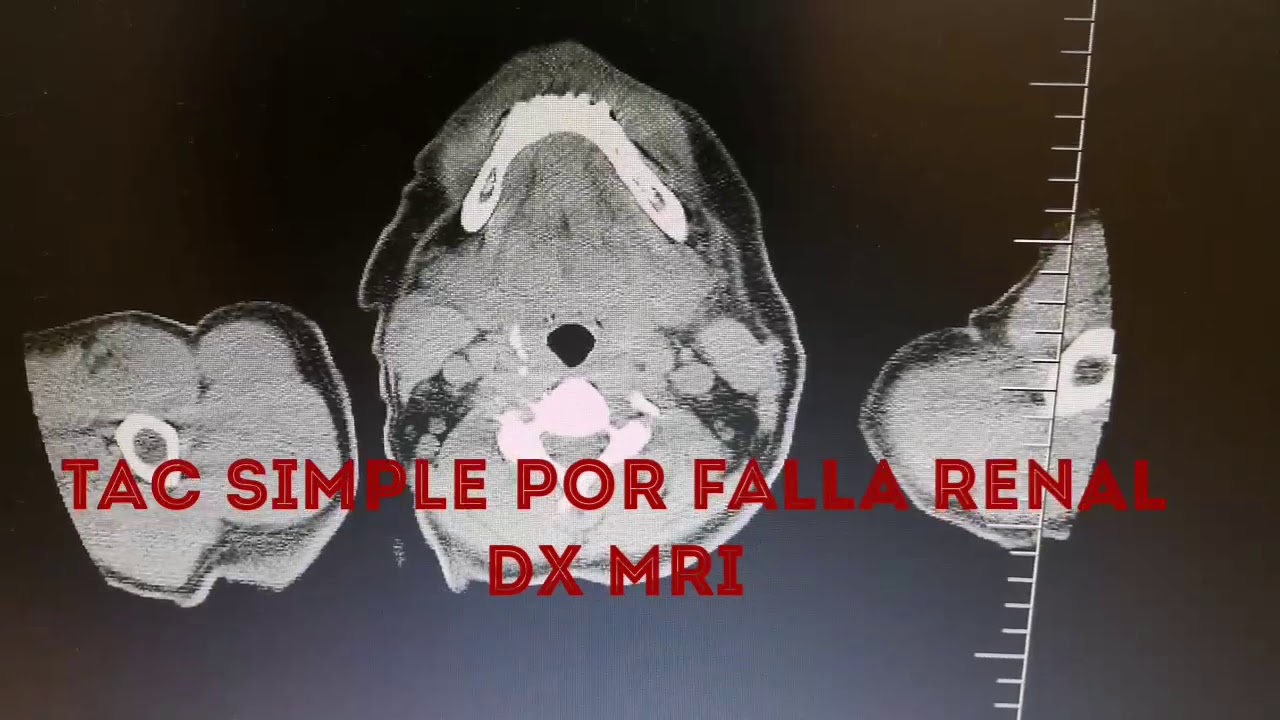 David Quintero Valencia-6