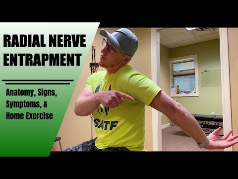 This Is How We Treat This Nerve Entrapment