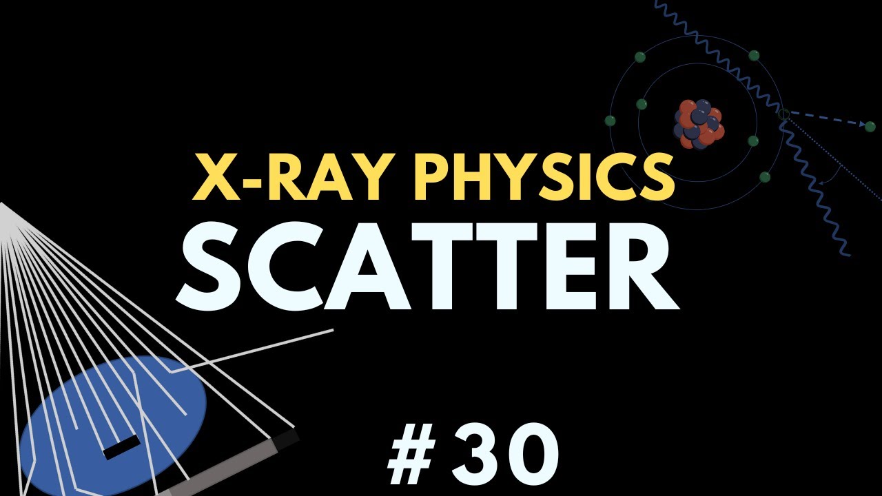 Scatter radiation and factors that influence scatter | X-ray Physics | Radiology Physics Course #37