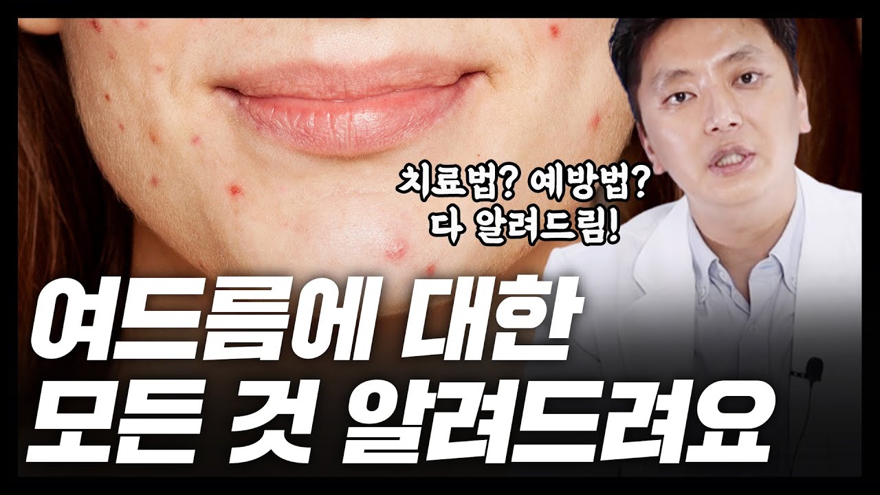 related_video_thumbnail