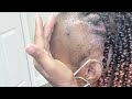 Tutorial Thin Edges Alopecia Cover Up Using Faux Locs Ms Pk S