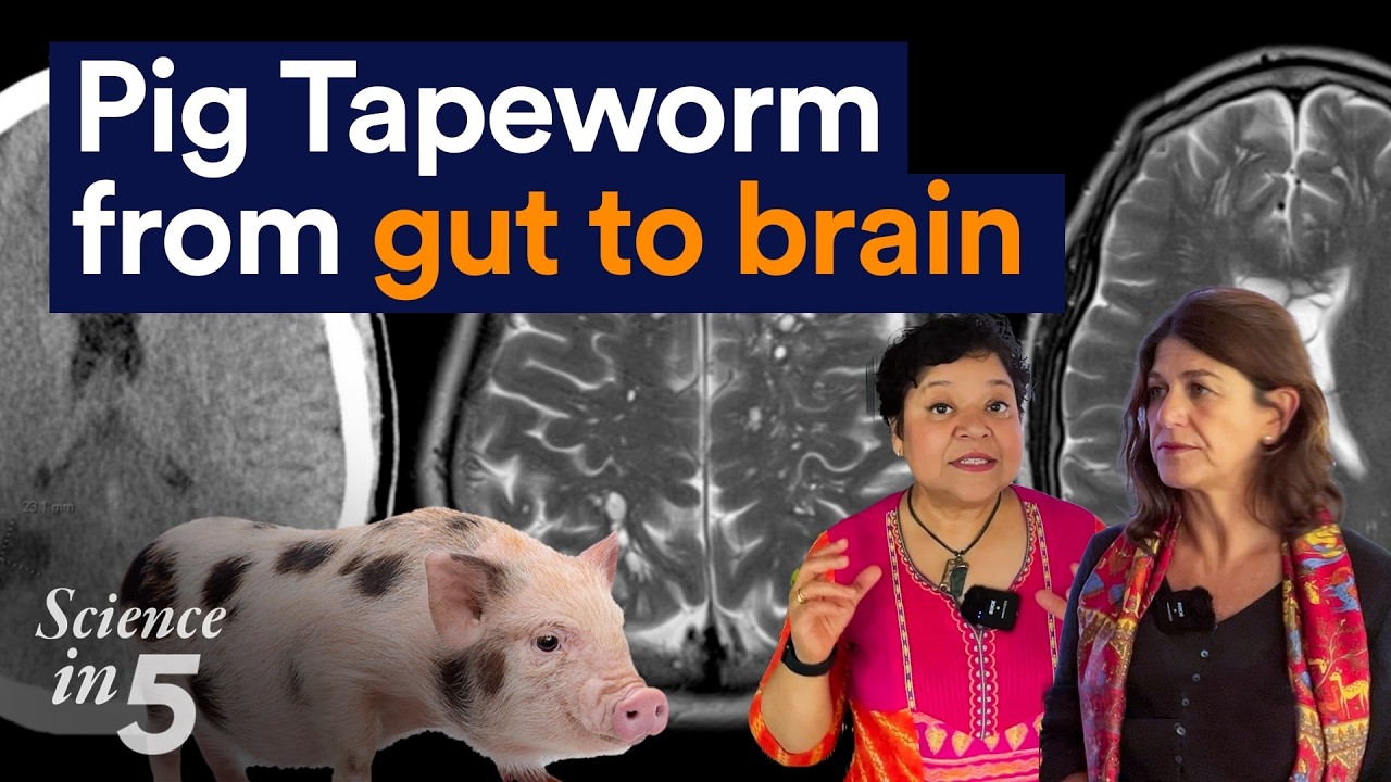 WHO's Science in 5 - Pig Tapeworm: from gut to brain - 24 October 2025