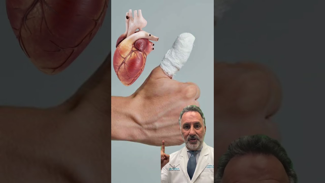 ¿Qué hacer si te cortas el dedo accidentalmente? El Dr. Badia explica #injury #finger #cutfinger
