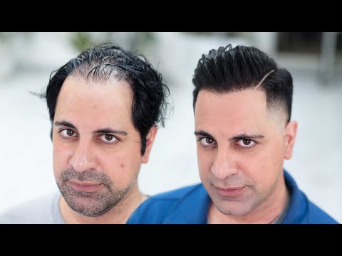 Get Gorgeous Hair with THICK FIBER! Watch the Hair Transformation!