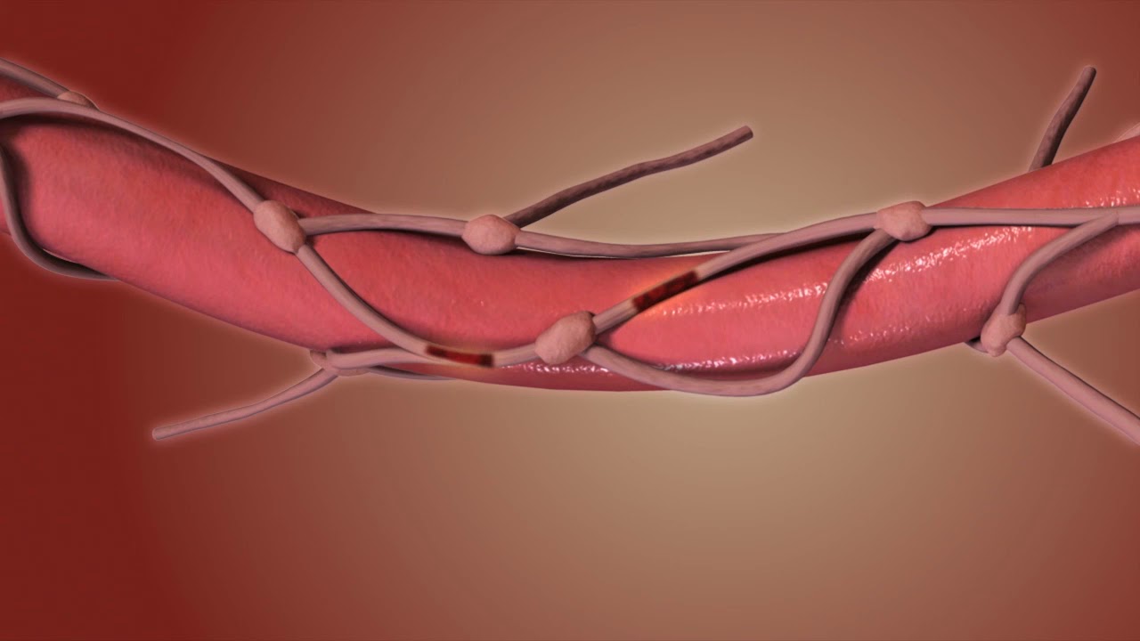 Recovery from Oesophageal Cancer