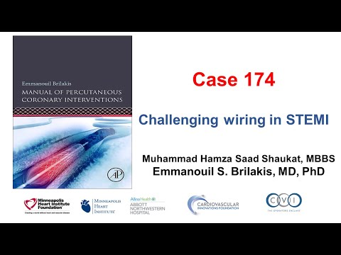 Case 174: Manual of PCI - Challenging wiring in STEMI