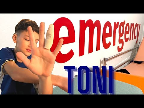 TONI JE SLOMIO PRST !!!!!!