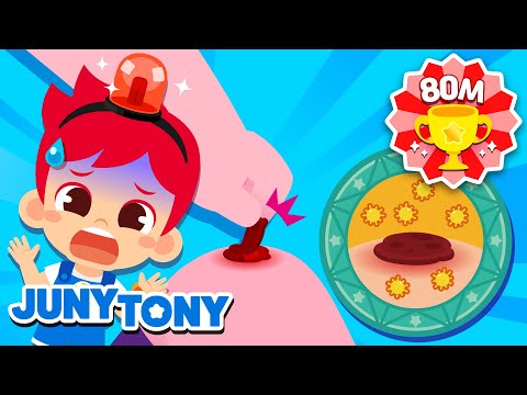 Why Do We Have Scabs on Scars? | Curious Songs for Kids | Wonder Why | Preschool Songs | JunyTony