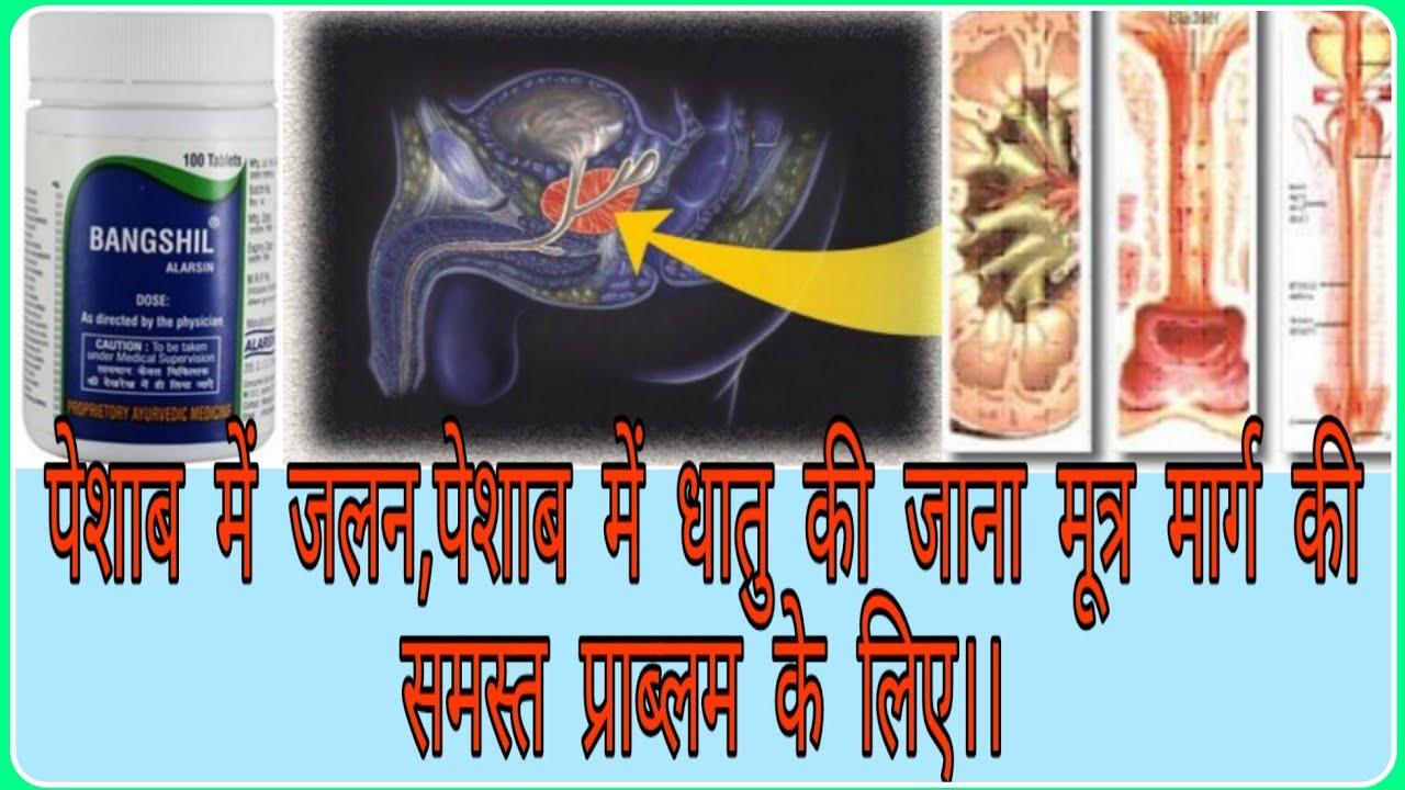 बंगशील टैबलेट(Bangshil Tabs)मूत्र की जलन,मूत्रमार्ग की पीड़ा,मूत्र कम आना,स्वप्नदोष,नपुंसकता, के लिए।