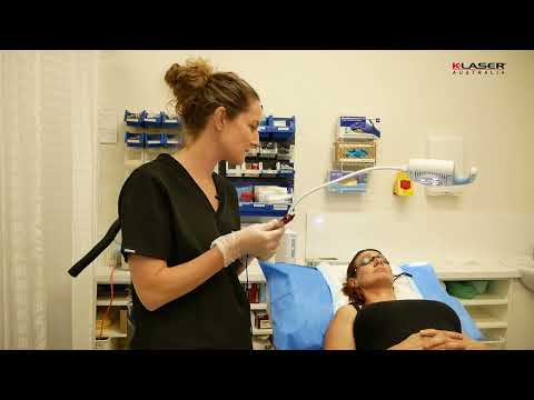 K-Laser Blue Derma - Carly Whytcross - Tiny Capillaries Skin rejuvenation