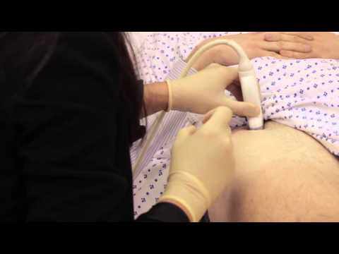 Fortius Clinic - pioneering treatment for chronic knee pain using Botox like treatment