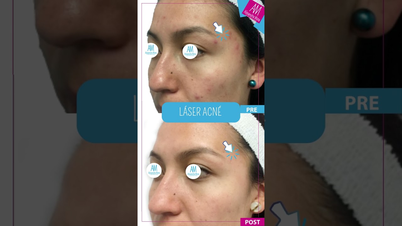 Alexandra Mora Hernandez-133