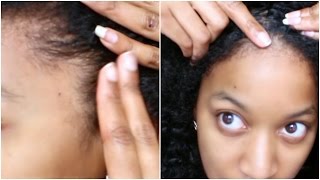 How I GREW OUT MY THIN EDGES On Natural Hair