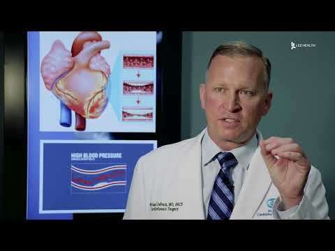 What is Coronary Angioplasty