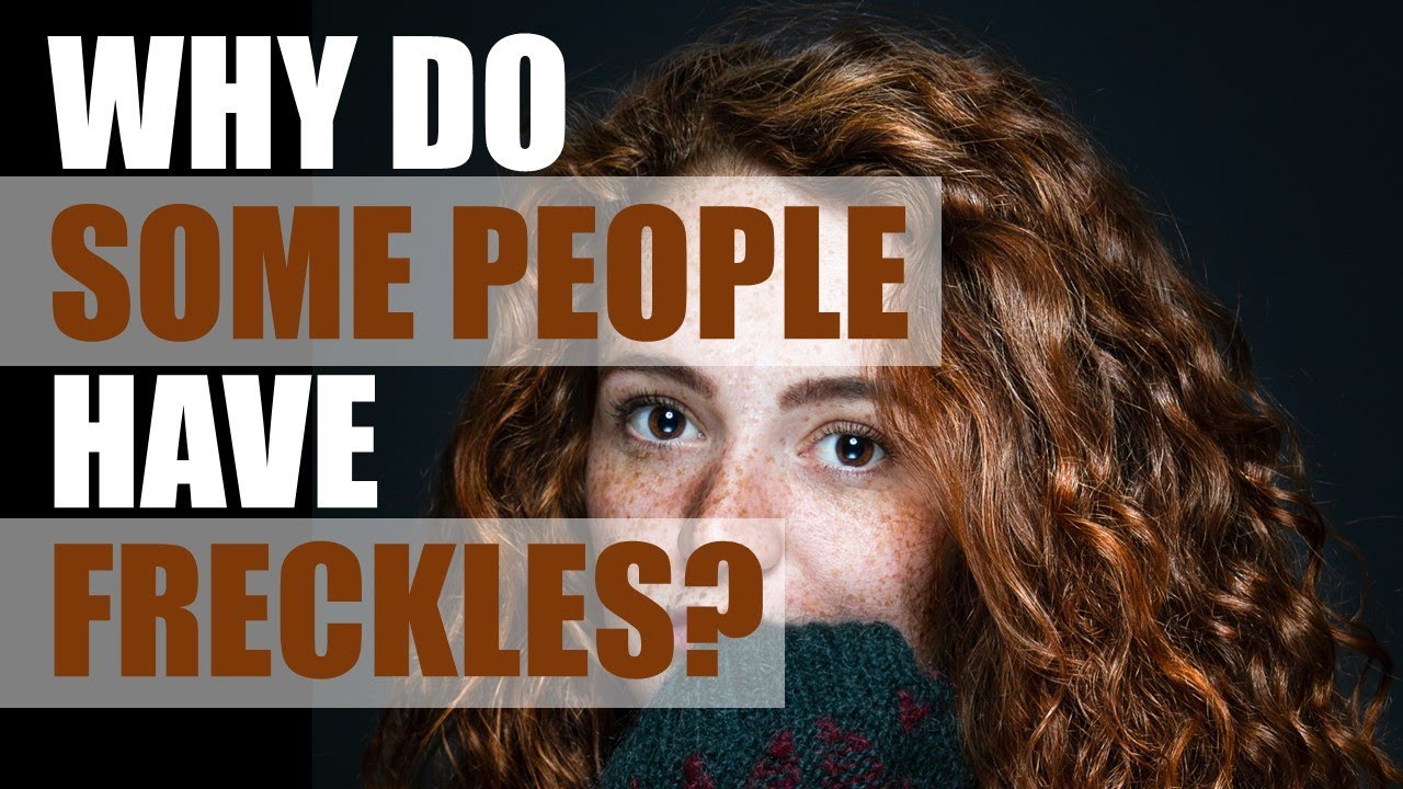 Is freckles genetically inherited?