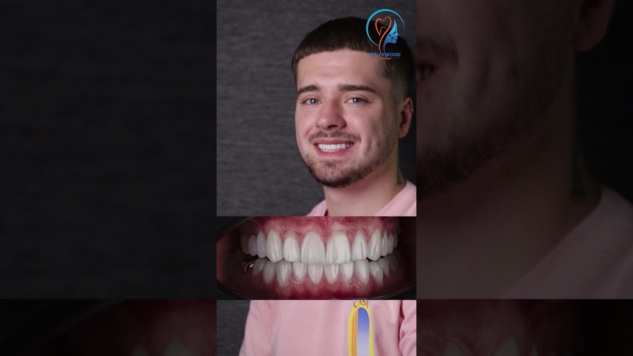 Video 4