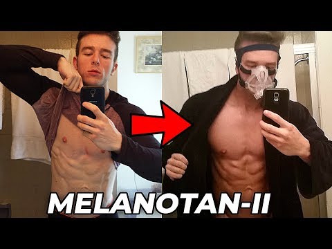 Melanotan II PERMANENTLY Darkened My Skin!