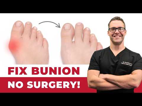 TOP 13 Ways to Shrink Bunions Naturally 1 HUGE SECRET
