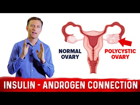 How To Fix Enlarged Prostate Explained By Dr Berg