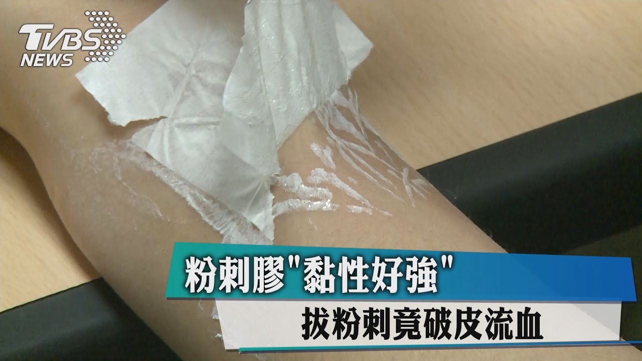粉刺膠「黏性好強」 拔粉刺竟破皮流血