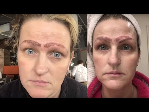 MICROBLADING FAIL: Woman has 4 eyebrows