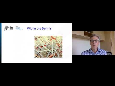 2020 Virtual Summer Conference: Prendre en Charge les Complications Dermatologiques by Dr. Nigel Burrows | French (FR)