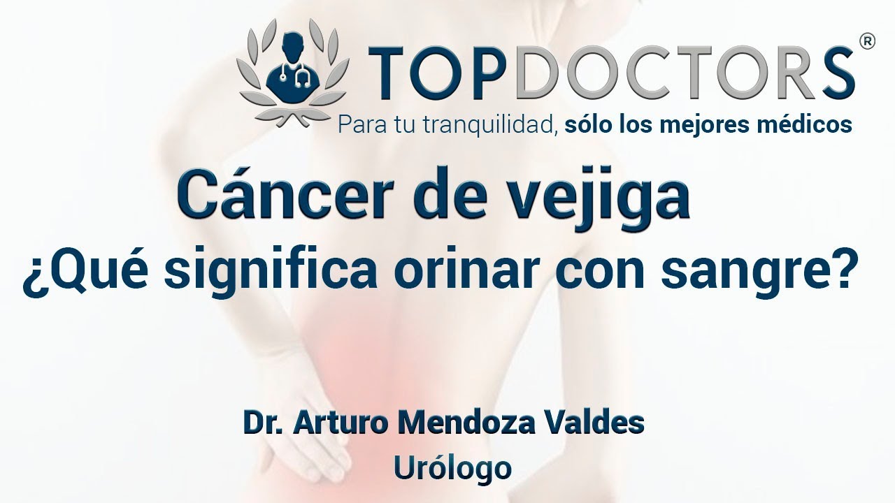 Arturo Mendoza Valdes-5