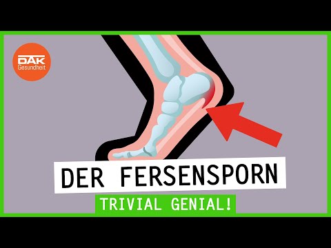 Fersensporn – Wenn die Füße schmerzen | Trivial Genial | DAK-Gesundheit