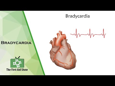Bradycardia