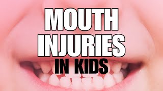 Pediatrician Explains: What to do When Your Child Has a Mouth Injury
