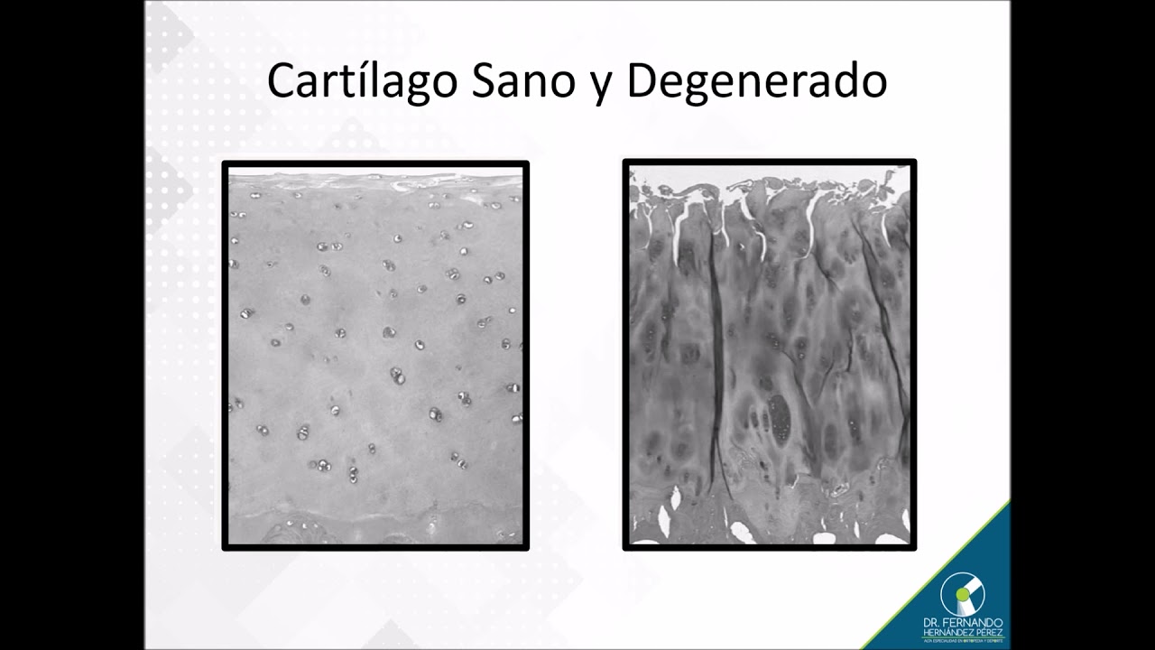 Fernando Hernández Pérez-40