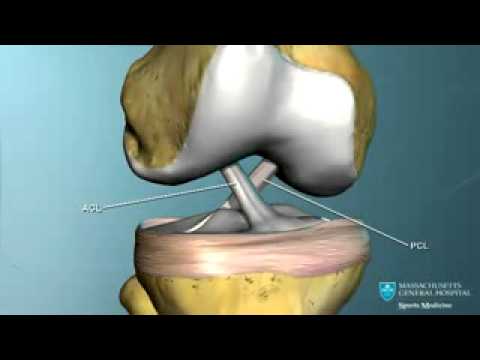 Intorpidimento in video osteocondrosi Bruciore alla schiena mentre si muove