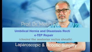 Miniaturka - Umbilical Hernia & Diastasis Recti. eTEP Repair. Metin Ertem.MD.FACS