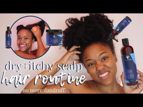 How to Get Rid of DANDRUFF on Natural Hair | As I Am...