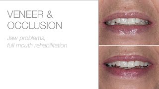 Pain relief - lifting vertical dimension into relaxed bite position